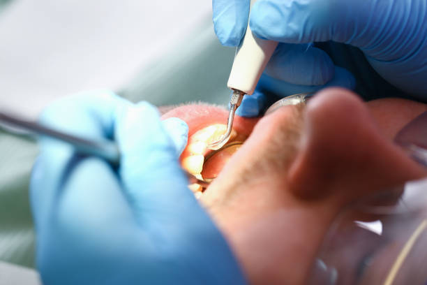 Best Pediatric Emergency Dentist in Port Richey, FL